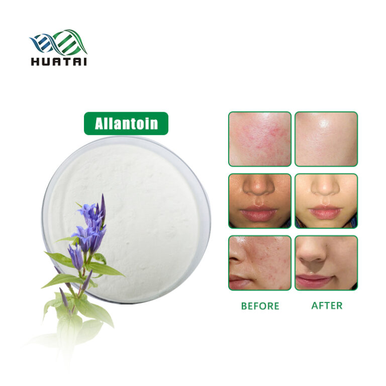 Allantoin